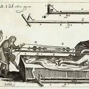 Setting a Bone 1682