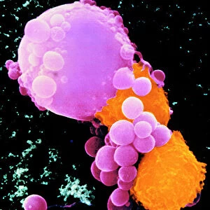 Coloured SEM of lymphocytes attacking cancer cell