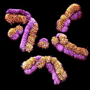 Human chromosomes, SEM C013 / 5005